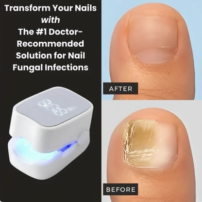 Nuvere™ Nail Fungus Laser Devise